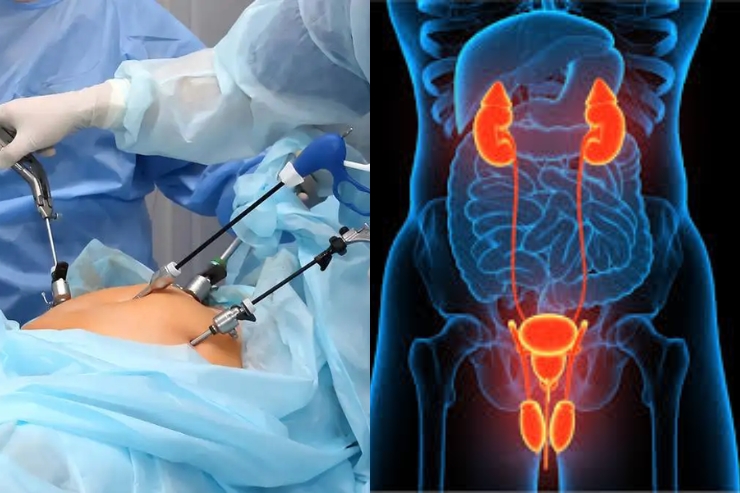 Laproscopic Surgery & Urology-----17