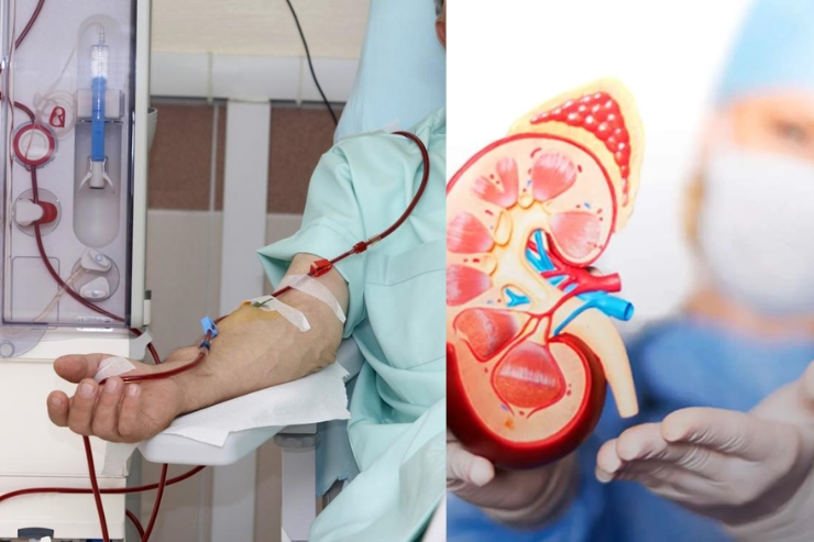 Nephrology & Dialysis